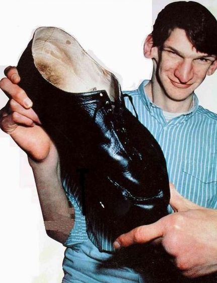 biggest-feet-ever